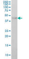 Inhibitor Of Nuclear Factor Kappa B Kinase Regulatory Subunit Gamma antibody, LS-C133550, Lifespan Biosciences, Western Blot image 
