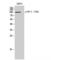 Eukaryotic Translation Elongation Factor 2 antibody, LS-C381457, Lifespan Biosciences, Western Blot image 