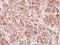 Acyl-CoA Dehydrogenase Very Long Chain antibody, NBP2-15238, Novus Biologicals, Immunohistochemistry frozen image 