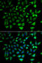 Mitochondrial carnitine/acylcarnitine carrier protein antibody, 22-526, ProSci, Immunofluorescence image 