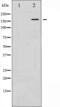 Kinase Insert Domain Receptor antibody, abx012340, Abbexa, Western Blot image 