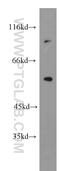 Cyclin Dependent Kinase Like 3 antibody, 13888-1-AP, Proteintech Group, Western Blot image 
