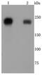 Integrin Subunit Beta 4 antibody, NBP2-66909, Novus Biologicals, Western Blot image 