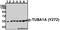 Protein Tyrosine Kinase 2 antibody, A00151S722, Boster Biological Technology, Western Blot image 