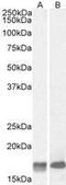 Galanin And GMAP Prepropeptide antibody, GTX88303, GeneTex, Western Blot image 