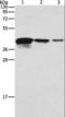 Twinfilin Actin Binding Protein 2 antibody, LS-C404630, Lifespan Biosciences, Western Blot image 