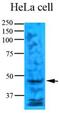 Thymidylate Synthetase antibody, MBS200172, MyBioSource, Western Blot image 