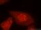 Myopalladin antibody, 16180-1-AP, Proteintech Group, Immunofluorescence image 