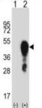Homeobox A1 antibody, abx028071, Abbexa, Western Blot image 