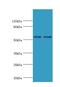 Solute Carrier Family 2 Member 1 antibody, LS-C376633, Lifespan Biosciences, Western Blot image 