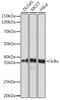 NFKB Inhibitor Alpha antibody, GTX32671, GeneTex, Western Blot image 