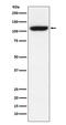 Transient Receptor Potential Cation Channel Subfamily M Member 8 antibody, M01002, Boster Biological Technology, Western Blot image 