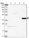 Zinc Finger Protein 396 antibody, NBP1-82025, Novus Biologicals, Western Blot image 