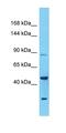 ADAM Metallopeptidase Domain 23 antibody, orb331427, Biorbyt, Western Blot image 