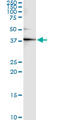 Creatine Kinase, M-Type antibody, LS-C196924, Lifespan Biosciences, Immunoprecipitation image 