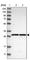 SCO Cytochrome C Oxidase Assembly Protein 1 antibody, HPA021579, Atlas Antibodies, Western Blot image 