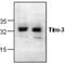 Hepatitis A Virus Cellular Receptor 2 antibody, GTX59896, GeneTex, Western Blot image 