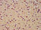 Solute Carrier Family 19 Member 2 antibody, LS-C672991, Lifespan Biosciences, Immunohistochemistry paraffin image 