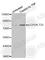 Component Of Inhibitor Of Nuclear Factor Kappa B Kinase Complex antibody, AP0173, ABclonal Technology, Western Blot image 