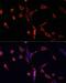 Cellular Communication Network Factor 2 antibody, LS-C746979, Lifespan Biosciences, Immunofluorescence image 