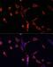 IBP-8 antibody, LS-C746979, Lifespan Biosciences, Immunofluorescence image 