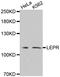 Leptin Receptor antibody, A2999, ABclonal Technology, Western Blot image 