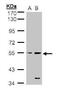Serine/Threonine/Tyrosine Kinase 1 antibody, PA5-21695, Invitrogen Antibodies, Western Blot image 
