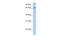 Autophagy Related 16 Like 1 antibody, 30-956, ProSci, Enzyme Linked Immunosorbent Assay image 