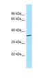 ALG12 Alpha-1,6-Mannosyltransferase antibody, orb330599, Biorbyt, Western Blot image 