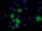 Chaperonin Containing TCP1 Subunit 8 Like 2 antibody, LS-C337858, Lifespan Biosciences, Immunofluorescence image 