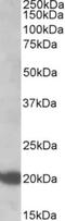 Ras antibody, NB100-94887, Novus Biologicals, Western Blot image 