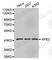 Nuclear Factor, Erythroid 2 antibody, A2209, ABclonal Technology, Western Blot image 