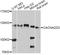 Calcium Voltage-Gated Channel Auxiliary Subunit Alpha2delta 3 antibody, A10315, ABclonal Technology, Western Blot image 