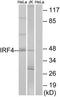 Interferon Regulatory Factor 4 antibody, TA314093, Origene, Western Blot image 