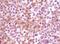 Synuclein Alpha antibody, NB110-89444, Novus Biologicals, Immunohistochemistry paraffin image 