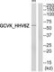 Dual specificity mitogen-activated protein kinase kinase 3 antibody, abx013497, Abbexa, Western Blot image 