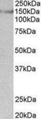 Synaptic Ras GTPase Activating Protein 1 antibody, NBP2-27541, Novus Biologicals, Western Blot image 