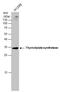 Thymidylate Synthetase antibody, GTX113289, GeneTex, Western Blot image 