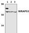 WD Repeat Containing Antisense To TP53 antibody, PA5-75161, Invitrogen Antibodies, Western Blot image 