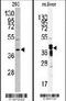 Aldo-Keto Reductase Family 7 Member A2 antibody, PA5-13999, Invitrogen Antibodies, Western Blot image 