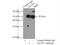 Glutamate dehydrogenase 1, mitochondrial antibody, 14299-1-AP, Proteintech Group, Immunoprecipitation image 