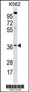 BUD23 RRNA Methyltransferase And Ribosome Maturation Factor antibody, 60-954, ProSci, Western Blot image 