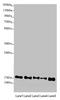 ATP Synthase F1 Subunit Delta antibody, LS-C675400, Lifespan Biosciences, Western Blot image 