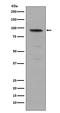 Signal Transducer And Activator Of Transcription 5A antibody, P01087-1, Boster Biological Technology, Western Blot image 