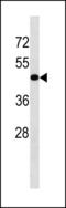 Transforming Growth Factor Beta Receptor 1 antibody, LS-C203901, Lifespan Biosciences, Western Blot image 