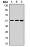 DNA Polymerase Delta 2, Accessory Subunit antibody, LS-C667764, Lifespan Biosciences, Western Blot image 