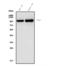 Phosphodiesterase 6A antibody, A07800-1, Boster Biological Technology, Western Blot image 