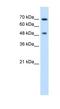 UV excision repair protein RAD23 homolog A antibody, NBP1-52920, Novus Biologicals, Western Blot image 