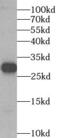 Spindlin 1 antibody, FNab08177, FineTest, Western Blot image 