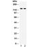 Toll Like Receptor 8 antibody, R32333, NSJ Bioreagents, Western Blot image 